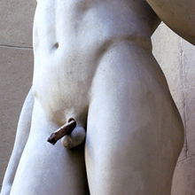 ぺロニー病の山崎邦正は大丈夫!?　 1時間以上の勃起は危険！