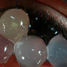 カエルのタマゴ